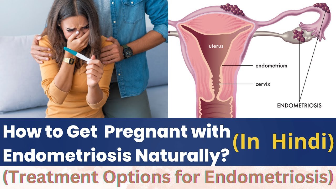 How to Improve Fertility and Get Pregnant with Endometriosis