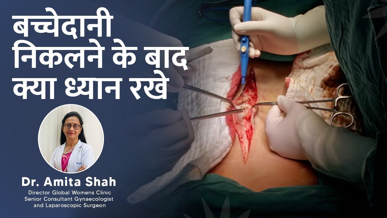 Care after hysterectomy || What to keep in mind after hysterectomy surgery?