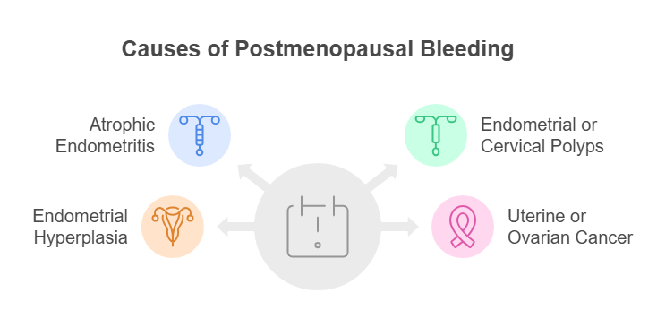 Causes of Postmenopausal Bleeding