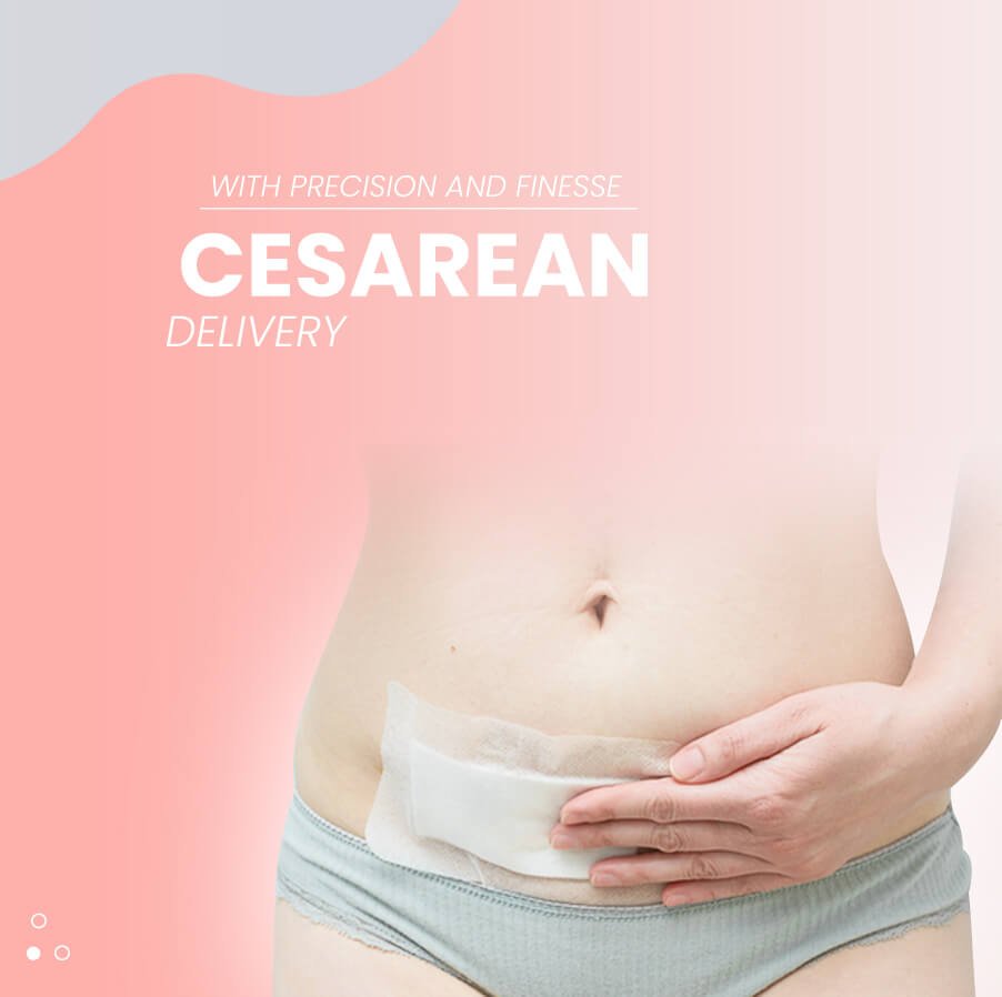 Cesarean Delivery mob