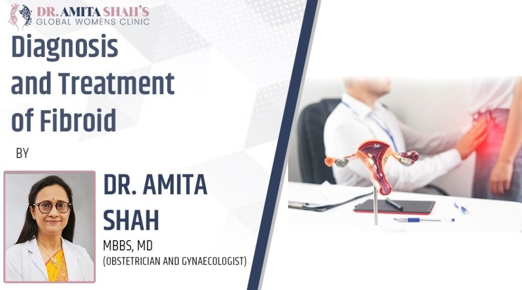 Diagnosis and treatment of fibroids