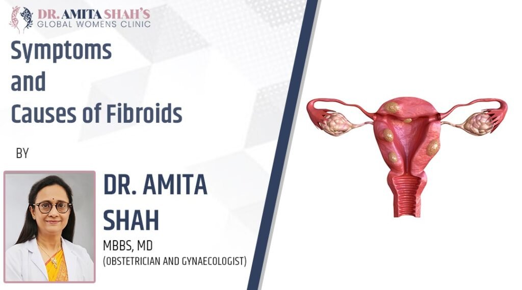 Fibroid symptoms and causes