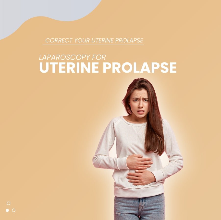 Laparoscopy for Uterine Prolapse 2