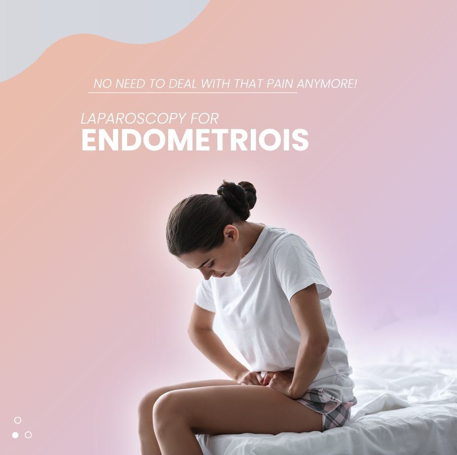 Laparoscopy for endometriosis 2