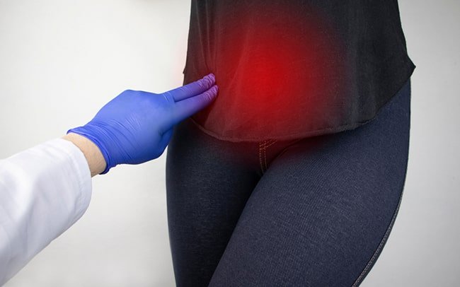 Laparoscopy for fibroids 4