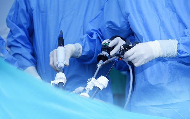 Laparoscopy for infertility