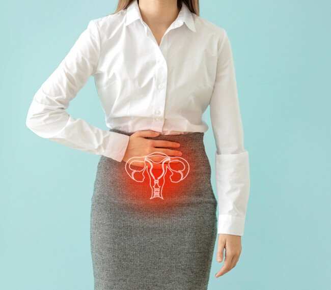 Menstrual Disorders 5