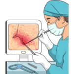 Minimally Invasive Procedures