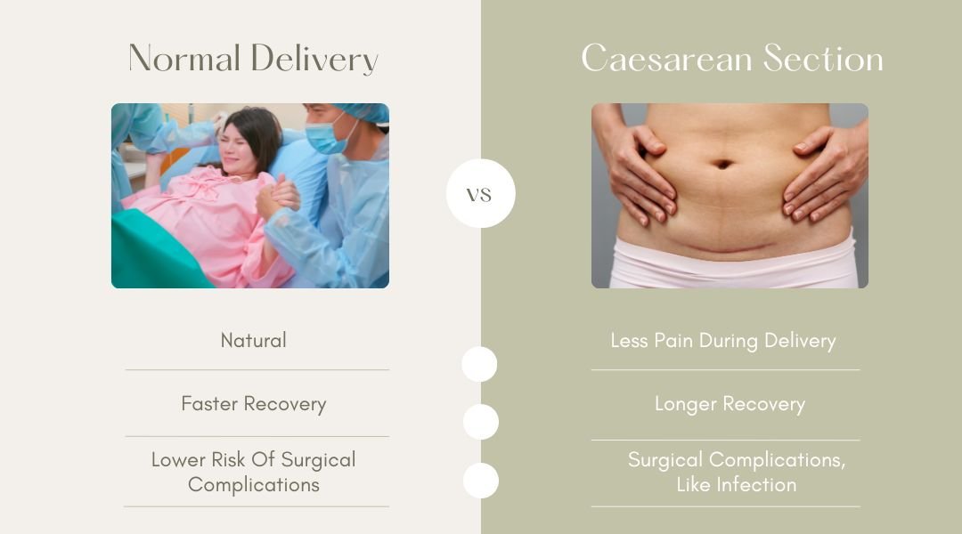 Normal Delivery or C Section Know What’s Best for You
