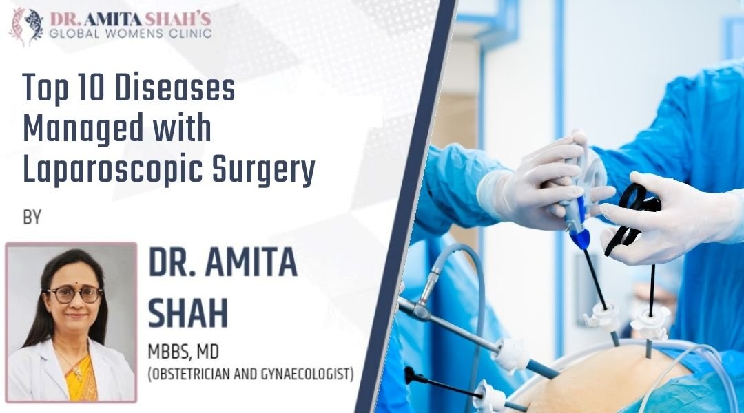 Top 10 Diseases Managed with Laparoscopic Surgery