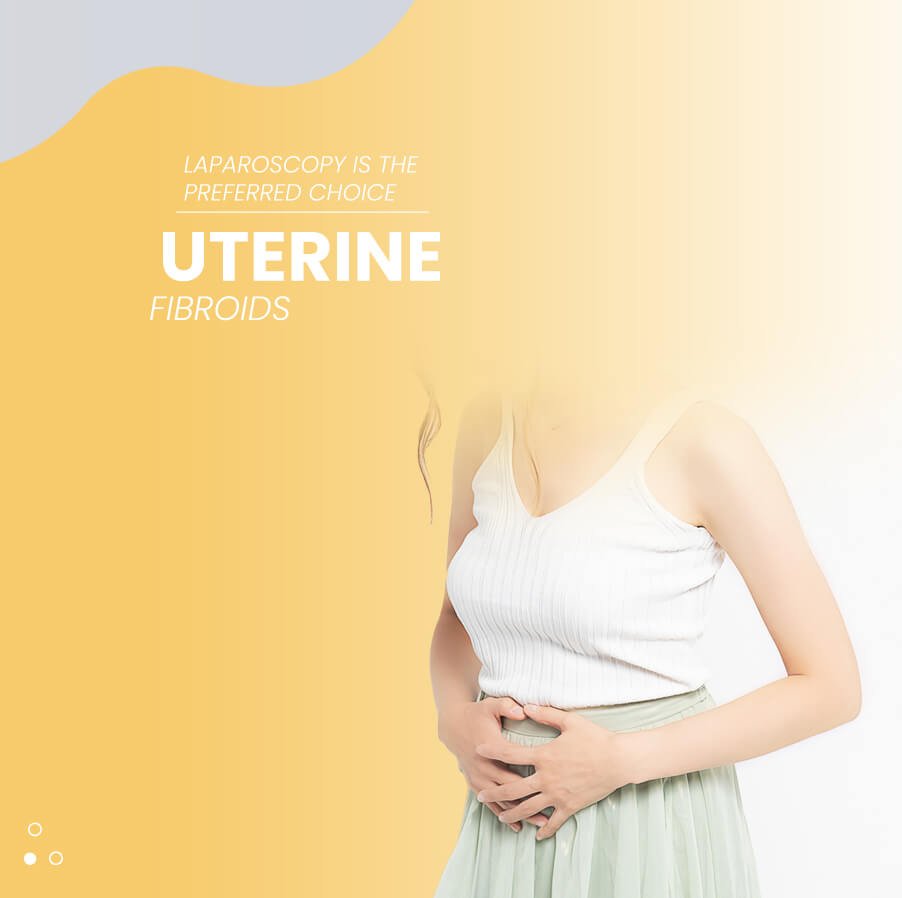 Uterine Fibroids mob