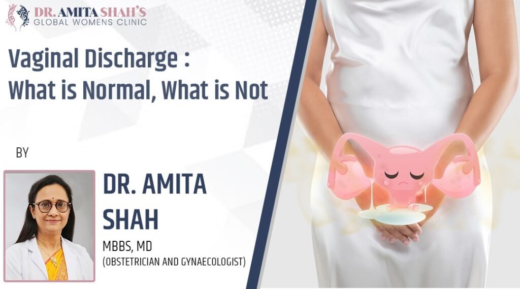 Vaginal Discharge What is normal what is not
