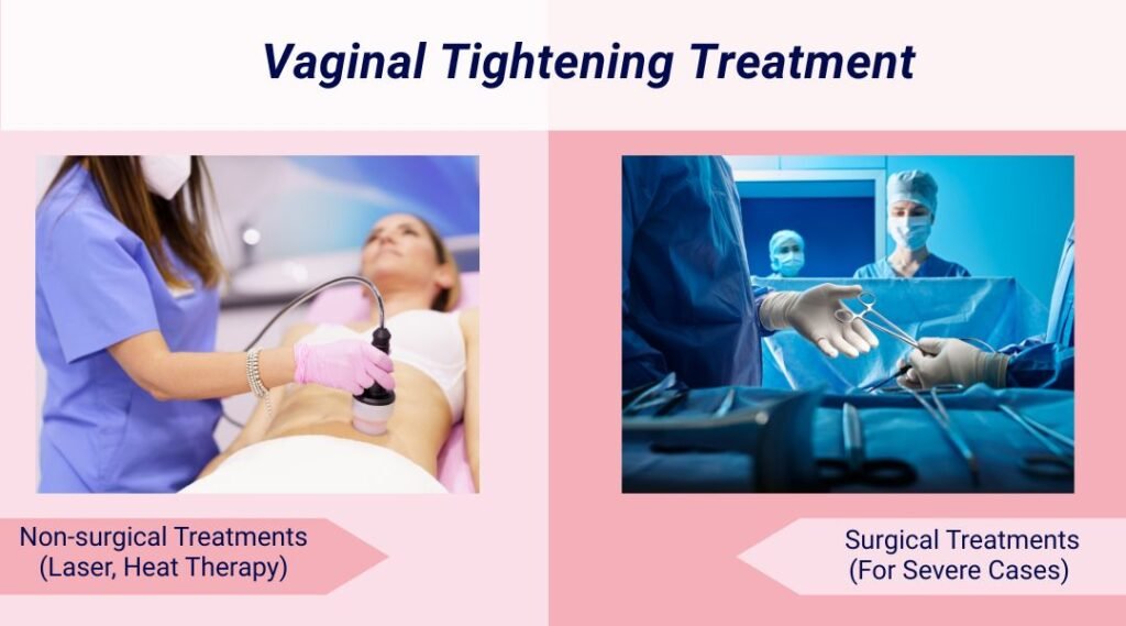 What is Vaginal Tightening Treatment Options You Should Know About