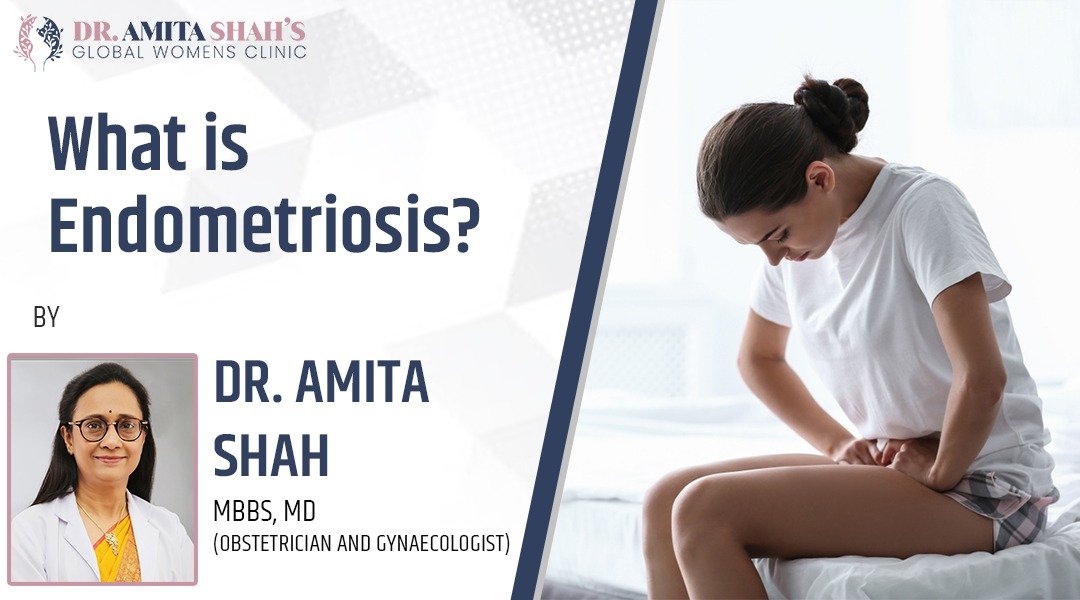 What is endometriosis Dr. Amita Shah