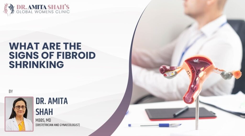 sign of Fibroid shrinking
